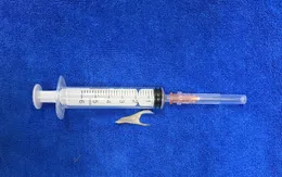 Cảnh báo dị vật hóc xương thực quản dịp Tết