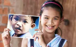 Khám miễn phí cho trẻ dị tật hàm mặt - tai mũi họng tại Gia Lai