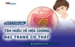 Tìm hiểu về hội chứng đại tràng co thắt