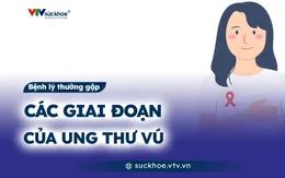 Các giai đoạn của ung thư vú