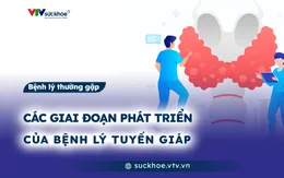 Các giai đoạn phát triển của bệnh lý tuyến giáp
