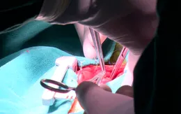 Đừng chủ quan sau sàng lọc sơ sinh: Phát hiện muộn ca tim bẩm sinh nặng