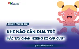 Khi nào cần đưa trẻ mắc tay chân miệng đi cấp cứu?