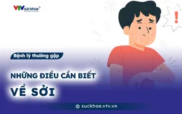 Những điều cần biết về sởi