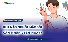 Khi nào người mắc sởi cần nhập viện ngay?