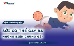 Sởi có thể gây ra những biến chứng gì?