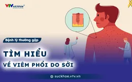 Tìm hiểu về viêm phổi do sởi