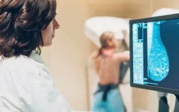 Phát hiện ung thư vú dù không có triệu chứng