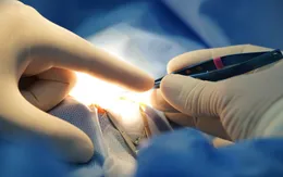 Bộ Y tế chấn chỉnh hoạt động hiến, ghép mô và bộ phận cơ thể người