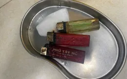 Gắp 3 bật lửa trong... dạ dày người bệnh