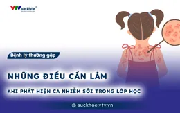 Những điều cần làm khi phát hiện ca nhiễm sởi trong lớp học