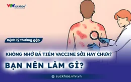 Không nhớ đã tiêm vaccine sởi hay chưa? Bạn nên làm gì?