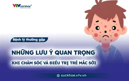 Những lưu ý quan trọng khi chăm sóc và điều trị trẻ mắc sởi
