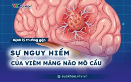 Sự nguy hiểm của viêm màng não mô cầu