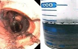 TP Hồ Chí Minh: Phác đồ chuẩn góp phần cứu sống nạn nhân ngạt khói vụ cháy tại Tân Thới Hiệp