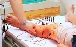 Đau gối tưởng thoái hóa, đi khám phát hiện ra mắc gout