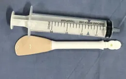 Gắp thành công bàn chải dài 30cm trong dạ dày bệnh nhân