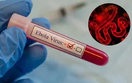 Bộ Y tế cập nhật tình hình dịch bệnh Ebola tại châu Phi