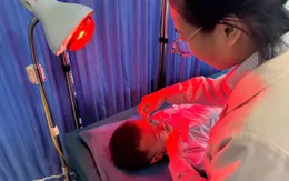 Bé trai méo miệng vì liệt dây thần kinh số VII