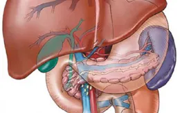 Bệnh gan nhiễm mỡ và những lưu ý cần thiết