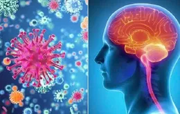 Mức độ nguy hiểm và dấu hiệu nhận biết bệnh viêm màng não