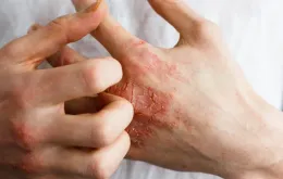 Câu chuyện về nỗi ám ảnh ‘nửa sống nửa chết’ vì loại thuốc hàng triệu người tin dùng