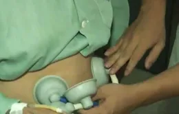 Tiến bộ mới chẩn đoán, điều trị rối loạn chức năng đại tiện