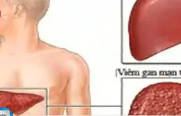 Khó tránh khỏi nhiễm bệnh viêm gan C khi xăm hình