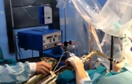 Bệnh nhân chơi saxophone khi đang phẫu thuật não