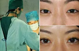 Phụ nữ Trung Quốc không ngại "đổ" tiền cho phẫu thuật thẩm mỹ