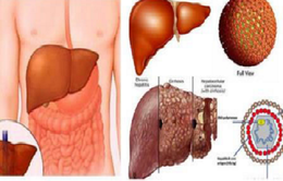 Chữa viêm gan B, C theo hướng điều trị suốt đời