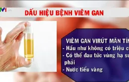 Phát hiện và điều trị bệnh viêm gan virus B và C