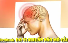 Dấu hiệu nhận biết sớm viêm não mô cầu