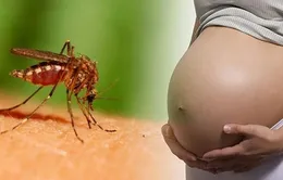 Thái Lan điều tra 4 trường hợp nghi mắc chứng đầu nhỏ do virus Zika