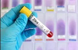 200 mẫu bệnh phẩm âm tính với virus Zika