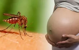 Phụ nữ siêu âm tuần thai nào để phát hiện dị tật đầu nhỏ do Zika?