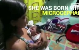 Bé mắc virus Zika may mắn được gia đình khác chăm sóc