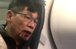 United Airlines “trắng án” sau vụ bạo lực hành khách