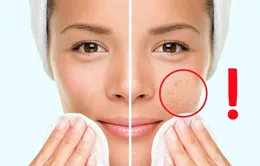 Những lưu ý để có một làn da đẹp hoàn hảo
