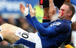 Sốc: Rooney dính chấn thương kinh hoàng, trọng tài vẫn từ chối penalty