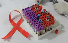 Lây nhiễm HIV/AIDS qua đường tình dục chỉ còn 5% nếu tuân thủ điều này