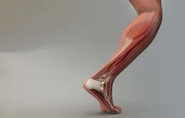Miếng cấy ghép thay thế gân và dây chằng