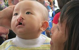 Phẫu thuật miễn phí cho trẻ dị tật khe hở môi vòm miệng