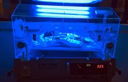 Vàng da ở trẻ sơ sinh: nguy hiểm nếu phát hiện muộn
