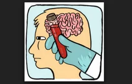 Thử máu phát hiện chấn thương sọ não