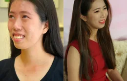 Cô gái nghèo và hành trình lấy lại nhan sắc