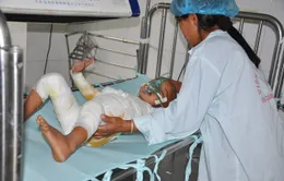 Ngã vào nồi cám lợn, bé 4 tuổi nguy kịch tính mạng