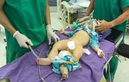 Điều trị lồng ruột cấp ở trẻ em