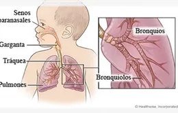 Trẻ bị viêm phổi xử trí thế nào?