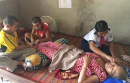 Người mẹ trẻ sắp mất chân trong cảnh gia đình khánh kiệt
